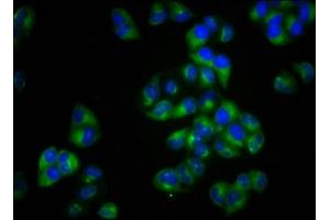 Immunofluorescence staining of Hela cells with ABIN7160327 at 1:100, counter-stained with DAPI. (MCTP2 Antikörper  (AA 129-240))
