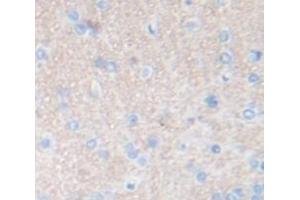 Immunohistochemistry (IHC) image for anti-Beta-secretase 1 (BACE1) (AA 181-366) antibody (ABIN1858109)