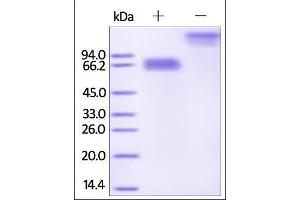 Human Mesothelin (aa 296-580), Fc Tag on SDS-PAGE under reducing (R) and no-reducing (NR) conditions.