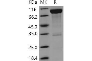 Western Blotting (WB) image for CD6 (CD6) (Active) protein (Fc Tag) (ABIN7194909) (CD6 Protein (CD6) (Fc Tag))