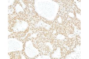 Immunohistochemistry (IHC) image for anti-Histone Deacetylase 2 (HDAC2) (C-Term) antibody (ABIN7454665)