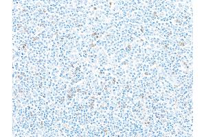 Immunohistochemistry (IHC) image for anti-Integrin, alpha E (Antigen CD103, Human Mucosal Lymphocyte Antigen 1, alpha Polypeptide) (ITGAE) (AA 400-450) antibody (ABIN7455115)