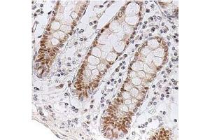Immunohistochemistry (IHC) image for anti-Checkpoint Kinase 2 (CHEK2) antibody (ABIN487312) (CHEK2 Antikörper)
