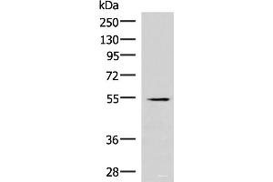 Western blot analysis of Human heart tissue lysate using IRX1 Polyclonal Antibody at dilution of 1:300 (IRX1 Antikörper)
