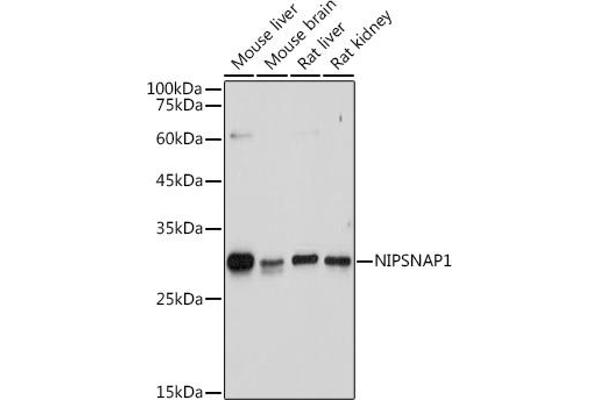 NIPSNAP1 Antikörper