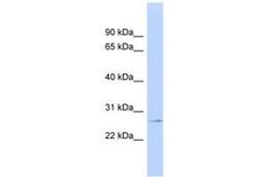 Image no. 1 for anti-Glutathione S-Transferase pi 1 (GSTP1) (AA 35-84) antibody (ABIN6743477) (GSTP1 Antikörper  (AA 35-84))