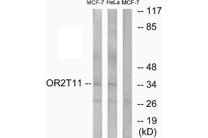 Western blot analysis of extracts from MCF-7 cells and HeLa cells, using OR2T11 antibody. (OR2T11 Antikörper  (Internal Region))