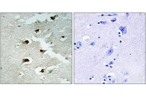Immunohistochemistry analysis of paraffin-embedded human brain tissue, using CDCA4 Antibody. (CDCA4 Antikörper  (AA 121-170))