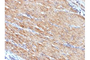 Immunohistochemistry (IHC) image for anti-Myosin Heavy Chain 11, Smooth Muscle (MYH11) antibody (ABIN6940156)