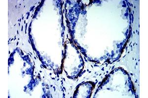 Immunohistochemistry (IHC) image for anti-Keratin 13 (KRT13) (AA 104-458) antibody (ABIN7193705)