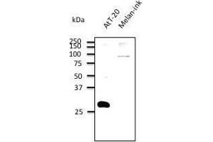 Anti. (RAB27B Antikörper  (C-Term))