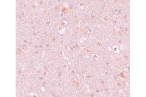 Immunohistochemical staining of human brain cells with CXXC4 polyclonal antibody  at 10 ug/mL. (CXXC4 Antikörper  (N-Term))