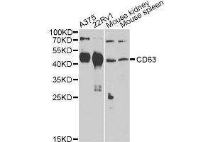 Western blot analysis of extracts of various cell lines, using CD63 Antibody (ABIN5974980) at 1/1000 dilution. (CD63 Antikörper)