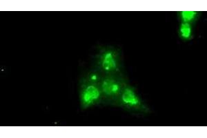 Image no. 2 for anti-Neurotrophic tyrosine Kinase, Receptor, Type 3 (NTRK3) antibody (ABIN1499841) (NTRK3 Antikörper)