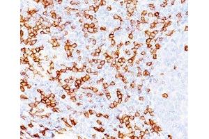 IHC testing of human tonsil (20X) stained with CD8a antibody (C8/468). (CD8 alpha Antikörper)