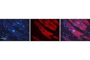 Rabbit Anti-SNX1 Antibody   Formalin Fixed Paraffin Embedded Tissue: Human heart Tissue Observed Staining: Cytoplasmic Primary Antibody Concentration: 1:100 Other Working Concentrations: N/A Secondary Antibody: Donkey anti-Rabbit-Cy3 Secondary Antibody Concentration: 1:200 Magnification: 20X Exposure Time: 0.