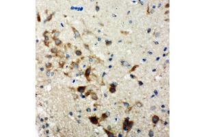 Anti-Hamartin antibody, IHC(P) IHC(P): Rat Brain Tissue
