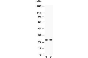 Western blot testing of Peroxiredoxin 6 antibody and Lane 1:  mouse liver;  2: human 293T lysate. (Peroxiredoxin 6 Antikörper  (AA 15-224))