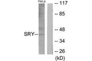 Western blot analysis of extracts from HeLa cells, using SRY Antibody.