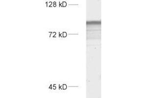 dilution: 1 : 1000, sample: rat brain homogenate (SYNPO Antikörper  (Isoform 2))