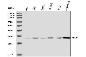 Western blot analysis of PRKRA using anti-PRKRA antibody (ABIN7600141).