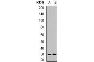 Western blot analysis of CLIC4 expression in mouse brain (A), rat brain (B) whole cell lysates. (CLIC4 Antikörper)