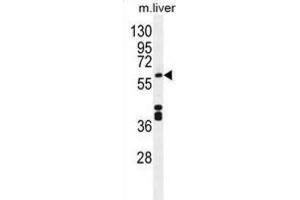 Western Blotting (WB) image for anti-Cytochrome P450, Family 1, Subfamily A, Polypeptide 2 (CYP1A2) antibody (ABIN2996139) (CYP1A2 Antikörper)