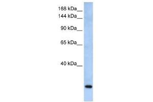 FBXW10 antibody used at 1 ug/ml to detect target protein. (FBXW10 Antikörper  (Middle Region))