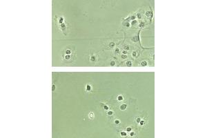 Immunohistochemistry. (NF-kB p65 Antikörper  (N-Term, NLS Domain))