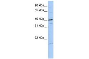 Image no. 1 for anti-Tubulin Polymerization-Promoting Protein Family Member 3 (TPPP3) (C-Term) antibody (ABIN6740766) (TPPP3 Antikörper  (C-Term))