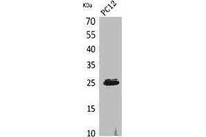 Western Blot analysis of PC12 cells using CMTM5 Polyclonal Antibody. (CMTM5 Antikörper  (N-Term))