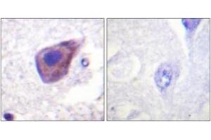 Immunohistochemistry (IHC) image for anti-Guanine Nucleotide Binding Protein (G Protein), alpha Z Polypeptide (GNaZ) (AA 1-50) antibody (ABIN2888875) (GNaZ Antikörper  (AA 1-50))