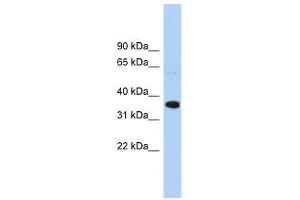 Western Blot showing WNT2B antibody used at a concentration of 1.