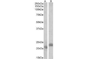 ABIN1590015 (2 µg/mL) staining of Mouse (A) and Rat (B) Spleen lysates (35 µg protein in RIPA buffer).