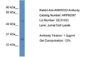 Western Blotting (WB) image for anti-Ankyrin Repeat Domain 32 (ANKRD32) (N-Term) antibody (ABIN2774286) (ANKRD32 Antikörper  (N-Term))