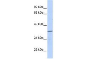 Image no. 1 for anti-Zinc Finger Protein 688 (ZNF688) (AA 108-157) antibody (ABIN6740519) (ZNF688 Antikörper  (AA 108-157))