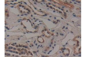 Immunohistochemistry (IHC) image for anti-Glutamate-Cysteine Ligase, Modifier Subunit (GCLM) (AA 40-251) antibody (ABIN7433051)