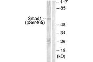 Western blot analysis of extracts from HeLa cells treated with Serum 10% 15', using Smad1 (Phospho-Ser465) Antibody. (SMAD1 Antikörper  (pSer465))