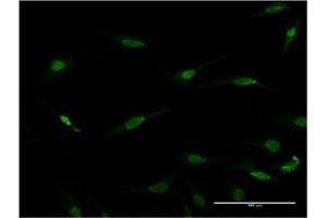 Immunofluorescence of monoclonal antibody to RAX on HeLa cell. (RAX Antikörper  (AA 253-346))