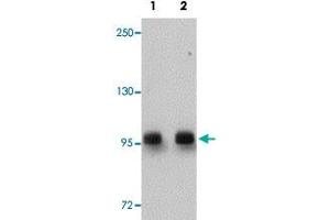 Western blot analysis of rat brain tissue with DCLK2 polyclonal antibody  at (Lane 1) 1 and (Lane 2) 2 ug/mL dilution. (DCLK2 Antikörper  (C-Term))