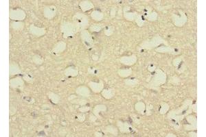 Immunohistochemistry of paraffin-embedded human brain tissue using ABIN7175065 at dilution of 1:100 (C11orf1 Antikörper  (AA 33-150))