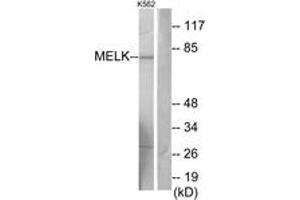 Western blot analysis of extracts from K562 cells, using MELK Antibody.