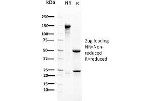 SDS-PAGE Analysis Purified RAD51 Mouse Monoclonal Antibody (RAD51/2702). (RAD51 Antikörper  (AA 1-134))