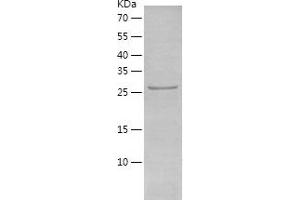 PPP1R10 Protein (AA 661-929) (His tag)