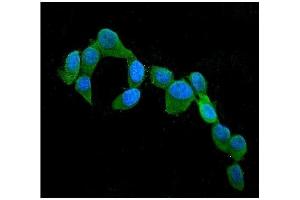 IF analysis of CST3 using anti-CST3 antibody (ABIN6719299). (CST3 Antikörper  (AA 31-146))