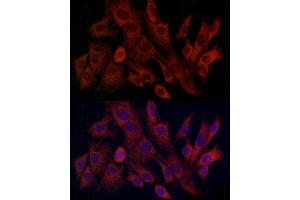 Immunofluorescence analysis of C6 cells using TIMM8A Rabbit pAb (ABIN6129145, ABIN6149172, ABIN6149173 and ABIN6225114) at dilution of 1:100 (40x lens). (TIMM8A/DDP Antikörper  (AA 1-97))