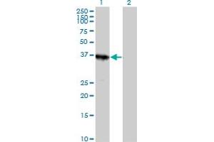 Western Blot analysis of ABT1 expression in transfected 293T cell line by ABT1 MaxPab polyclonal antibody. (Activator of Basal Transcription 1 Antikörper  (AA 1-272))