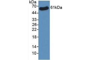 Western Blotting (WB) image for anti-Voltage-Dependent Anion Channel 1 (VDAC1) (AA 2-283) antibody (ABIN7427192)