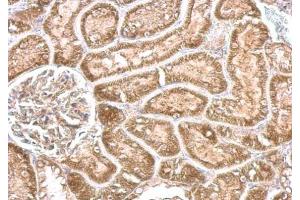 Immunohistochemistry (IHC) image for anti-Cytochrome P450, Family 24, Subfamily A, Polypeptide 1 (CYP24A1) (Center) antibody (ABIN2856211)