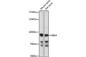 Western blot analysis of extracts of various cell lines, using NEK4 antibody (ABIN7268917) at 1:1000 dilution. (NEK4 Antikörper  (AA 1-300))